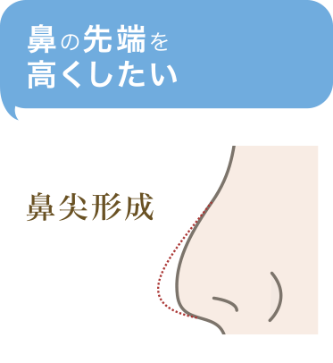 鼻の先端を高くしたい