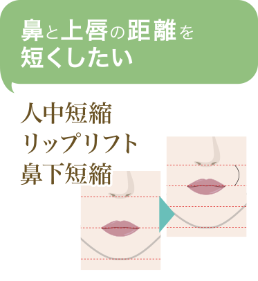 鼻と上唇の距離を短くしたい