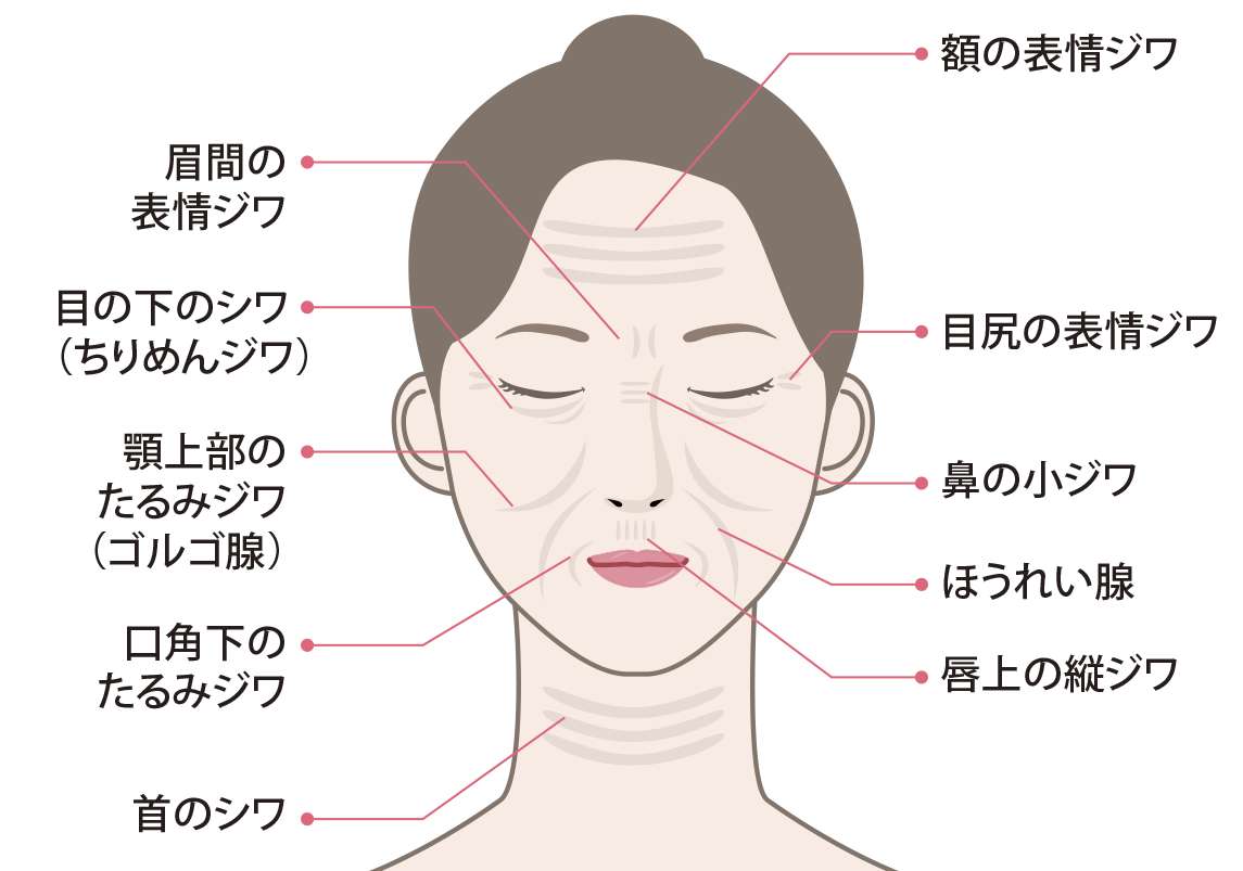 しわたるみの種類