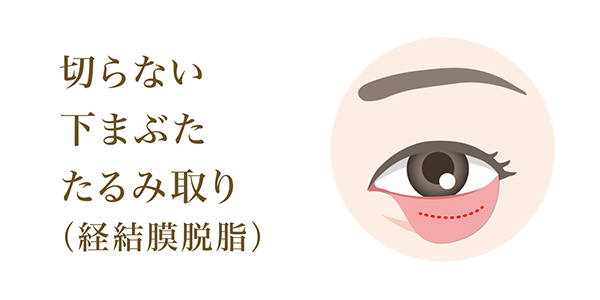切らない 下まぶた たるみ取り (経結膜脱脂) 