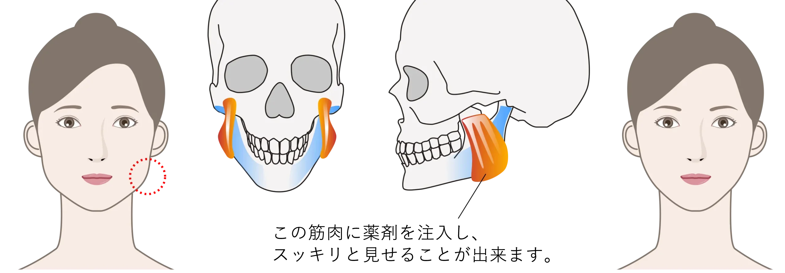 defined_jawline